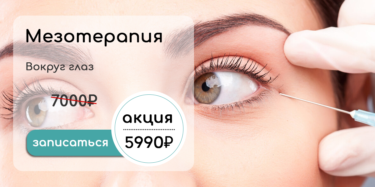Акция - Мезотерапия вокруг глаз