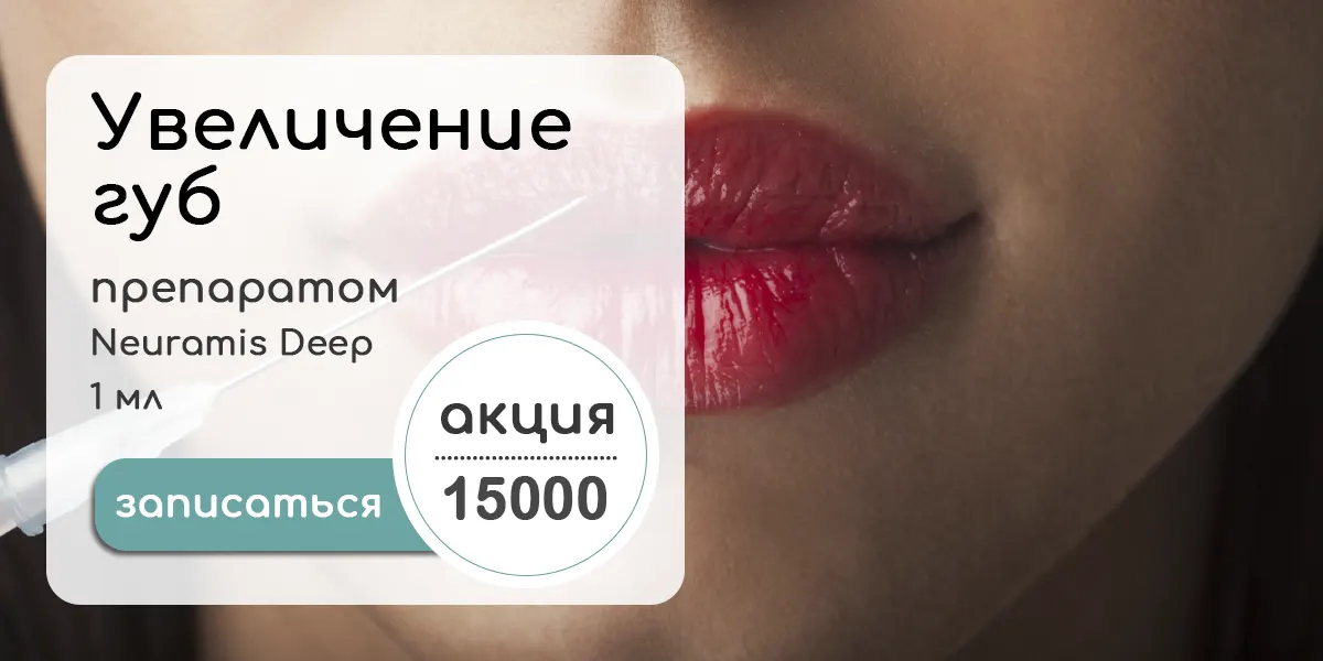 Акция - увеличение губ препаратом Neuramis Deep