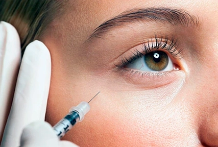 Подготовка к процедуре - Биоревитализация вокруг глаз