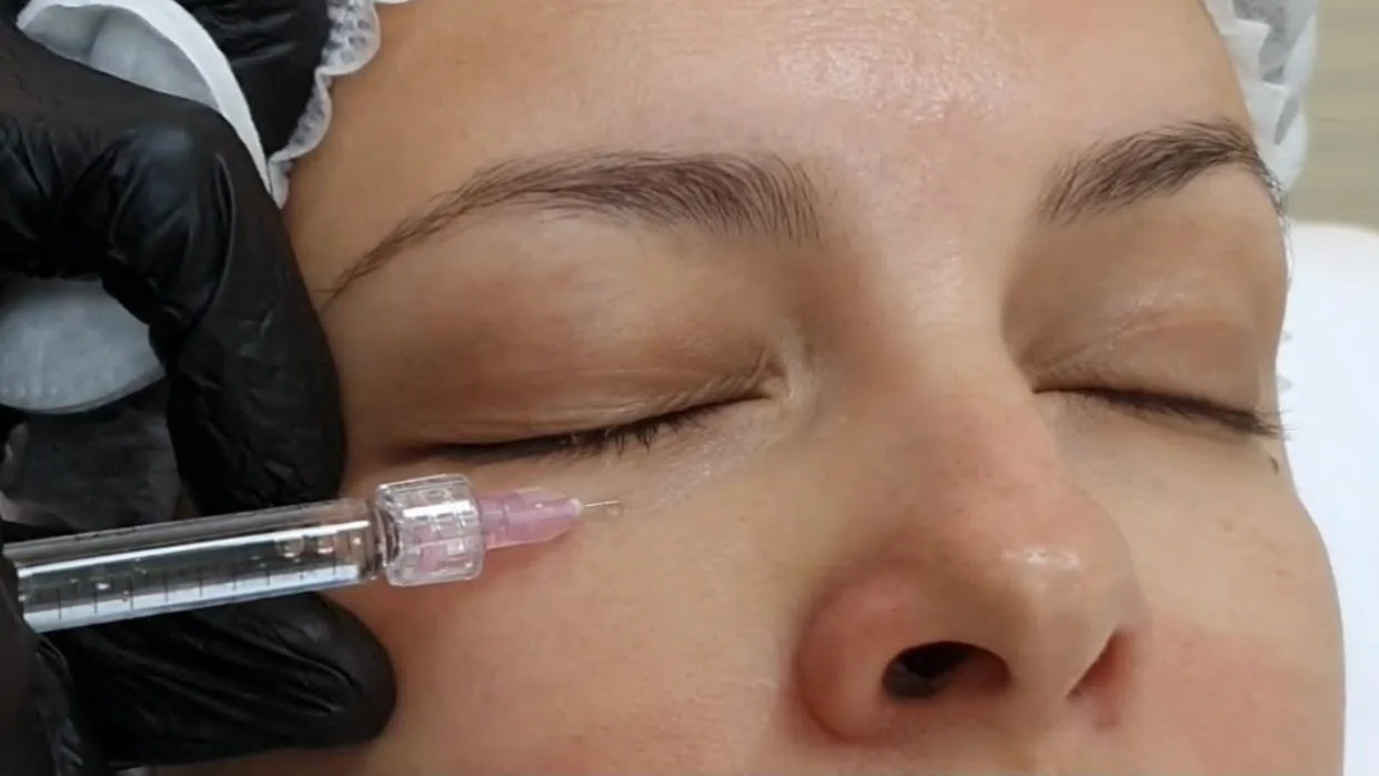 Подготовка к процедуре - F eye contur мезотерапия