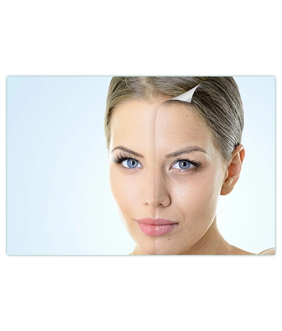 Подготовка к процедуре - Фотоомоложение аппаратом Lumecca